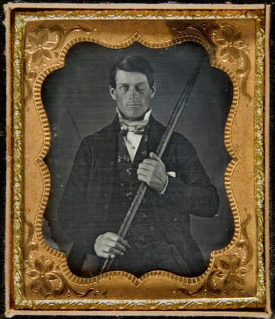 „phineasgage“